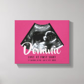 Sonogram Keepsake Baby Echografie Canvas Print (Voorkant)
