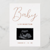 Sonogram Roos Gold Foil Zwangerschap Aankondiging (Voorkant)