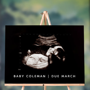 Sonogram van zwangerschapsaankondiging Baby shower Acryl Bord