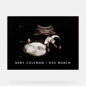 Sonogramme de Baby shower de grossesse (Recto)