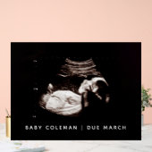 Sonogramme de Baby shower de grossesse (Mariage)