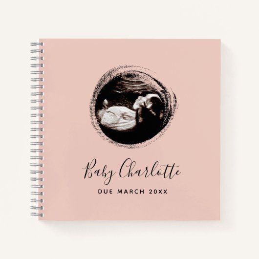 Sonogramme de fille rose Ultrasound Livre de gross (Devant)