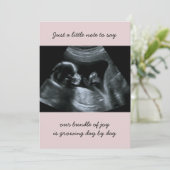 Sonogramme Photo Faire-part de grossesse rose pâle (Debout devant)