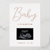 Sonogramme Rose Gold Foil Faire-part de grossesse (Recto)