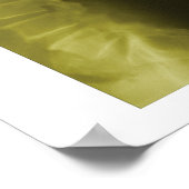 Spinal Degeneration Lumbar Spine Chiropractic Poster (Hoek)