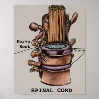 Spinale kabel poster