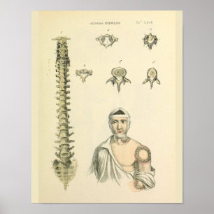 Spinale kolom Vertebrae Anatomie Art Afdrukken Poster