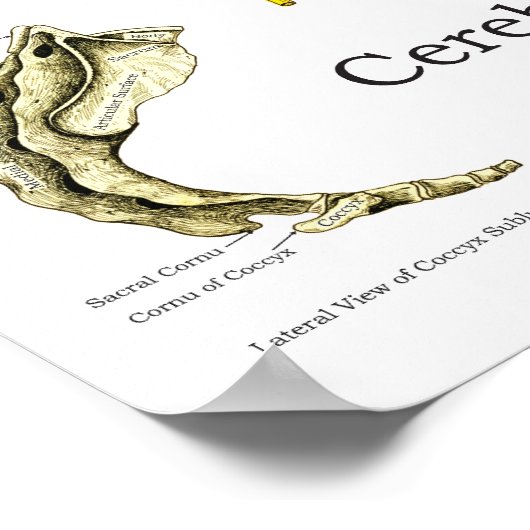 Spinale zenuwen Chiropractische subluxaties Poster (Hoek)