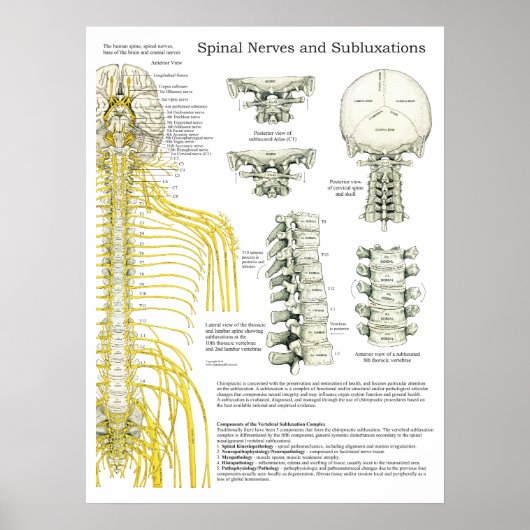 Spinale zenuwen en subluxe Chiropraktijk Poster (Voorkant)