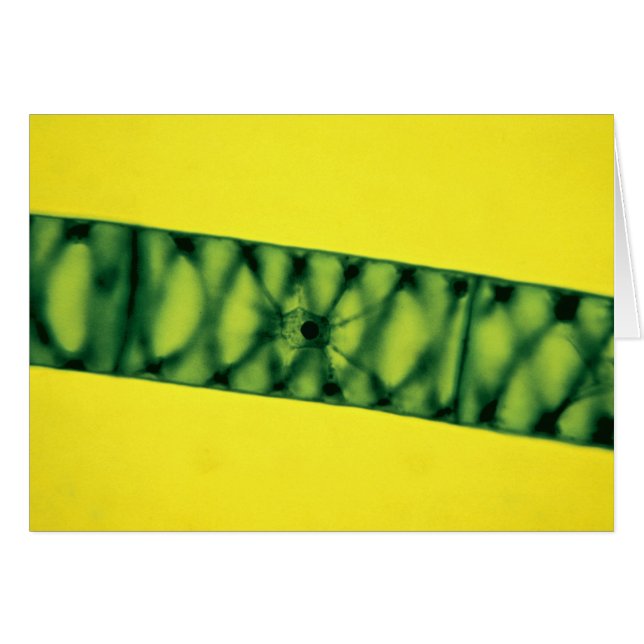 Spirogyra Green Algae (Voorkant Horizontaal)