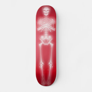 Squelette brillant : Skateboard personnalisé
