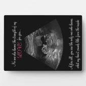Sterkte van de liefde van moeder Sonogram Keepomwi Fotoplaat (voorkant)