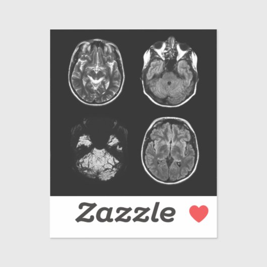 Sticker Analyse IRM du cerveau (Feuille)