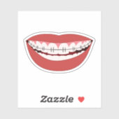 Sticker Appliance orthodontique Smile (Feuille)
