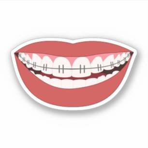 Sticker Appliance orthodontique Smile