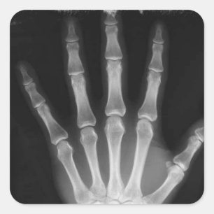 Sticker Carré B&W X-ray Skeleton Main
