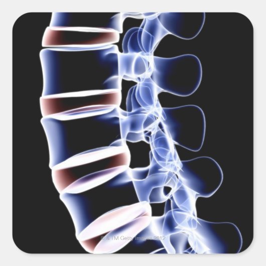 Sticker Carré Lumbar Vertebrae 2 (Devant)