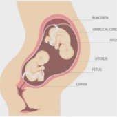 Sticker Grossesse jumelle dizygotique (Devant)