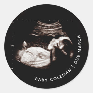 Sticker Rond Faire-part de grossesse Sonogramme bébé Photo
