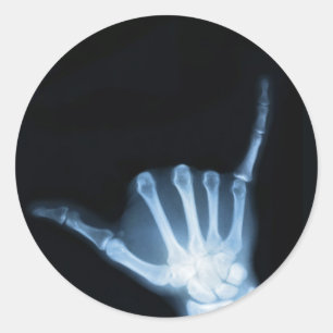 Sticker Rond SYMBOLE Shaka X-Ray (Perdre la main)