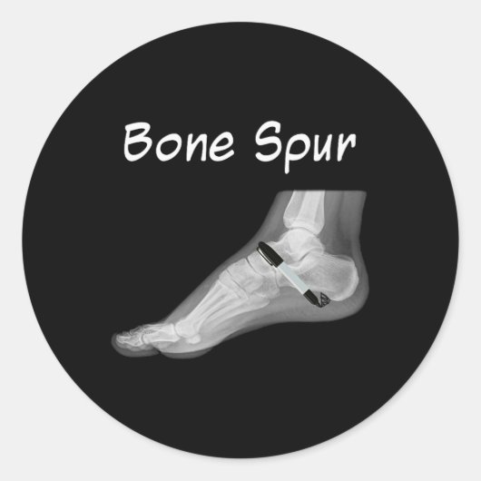 Sticker Rond Trump Bone Spur Ink Pen Funny Anti Trump (Devant)