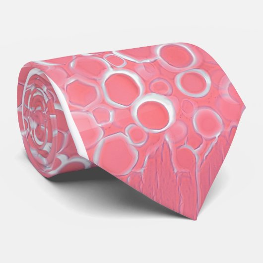 Stropdas corticaal cataract (Opgerold)