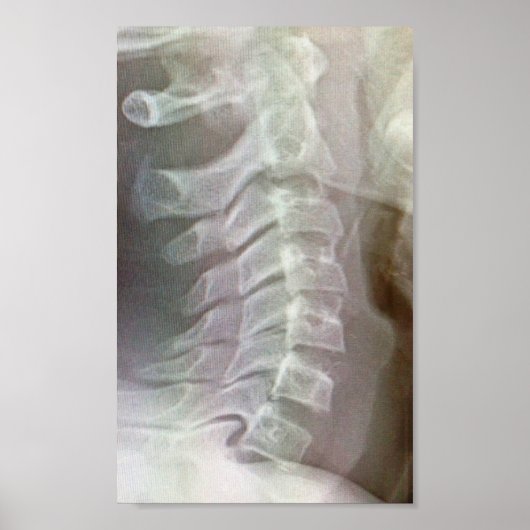 Stropdas van baarmoedermelk poster (Voorkant)