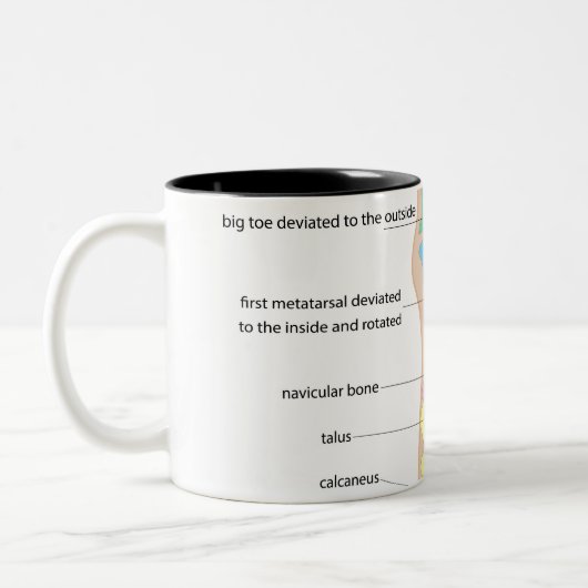 Structuur van de menselijke voet tweekleurige koffiemok (Links)
