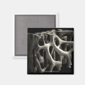 Structuur van een bot met osteoporose magneet (Voorkant / Achterkant)
