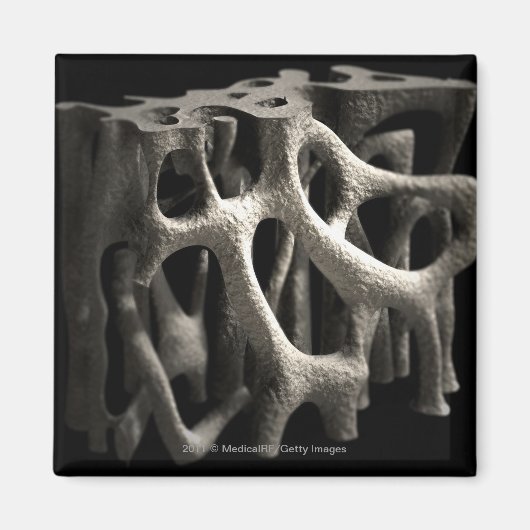 Structuur van een bot met osteoporose magneet (Voorkant)