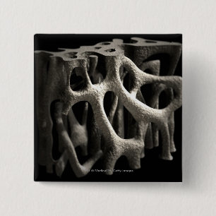 Structuur van een bot met osteoporose vierkante button 5,1 cm