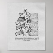 Subluxe chiropratique Impression Vintage (Devant)