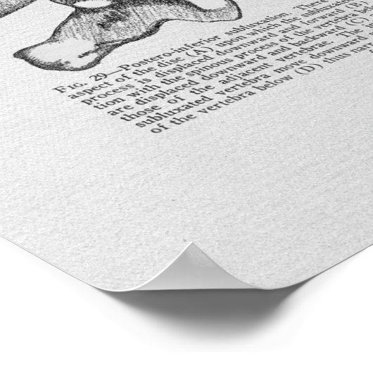 Subluxe Vertébrale Chiropratique Impression Vintag (Coin)