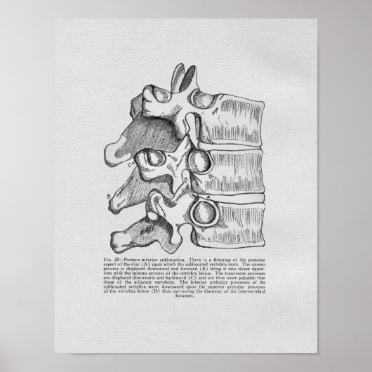 Subluxe Vertébrale Chiropratique Impression Vintag (Devant)