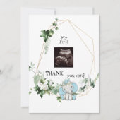 Super Ultrasound Merci Baby Boy Viewpoint (Devant)