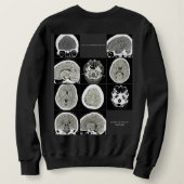 Sweatshirt Ce type de dépressionlookslike_FULLCTScan (Design dos)