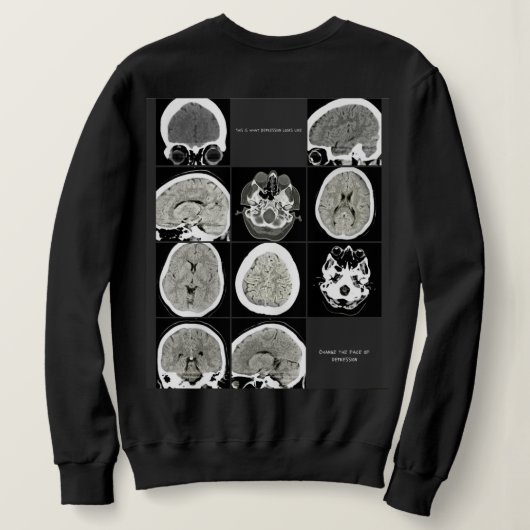 Sweatshirt Ce type de dépressionlookslike_FULLCTScan (Design dos)