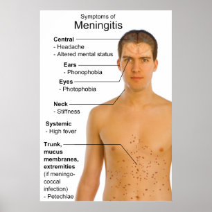 Symptomen Grafiek van ontsteking Meningitis Poster
