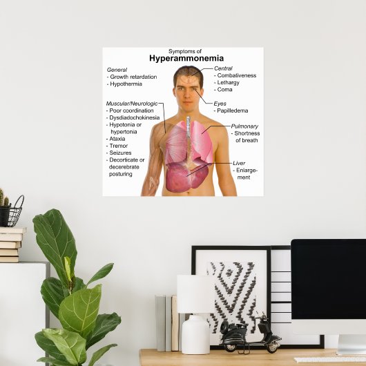 Symptomen Grafiek van stofwisselingsziekte Hyperam Poster (Thuiskantoor)