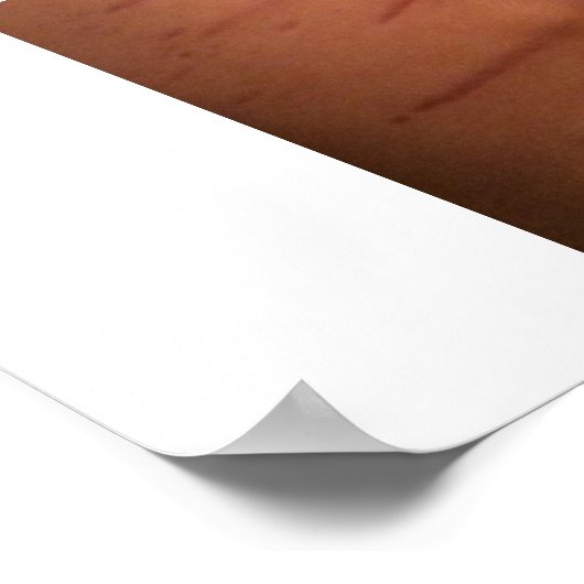 Symptômes Bartonella Poster éducatif (Coin)