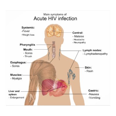 symptomes_principaux_de_linfection_par_le_hiv_aig_poster-rf6e7c95423aa4a2185f0ec2eb2c908d1_cav_400.jpg