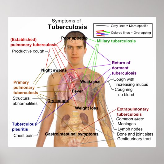 Symptoomgrafiek van tuberculose bij de mens poster (Voorkant)