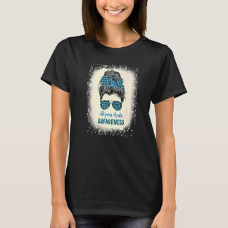 T-shirt Alopecia Areata Sensibilisation Messy bun Perte de