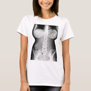 T-shirt Corps féminin Xray Skeleton Photo