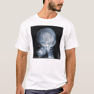 T-shirt Étude de cas : Joueur de Roto Tom
