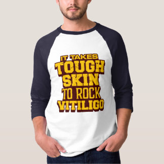 T-shirt Il prend la peau dure au vitiligo de roche
