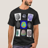 Images de cerveau