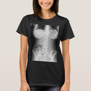 T-shirt Médicale Xray Photo anatomie du corps humain