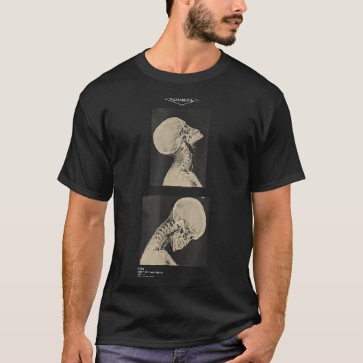 T-shirt Paramore cropped headbanger x-ray médecins  (Devant)