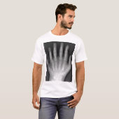 T-shirt Polydactyly, six mains digitées, rayon X, rareté ! (Devant entier)
